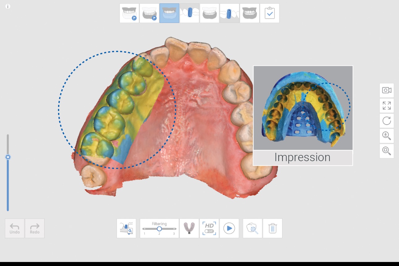digitalna Stomatologija