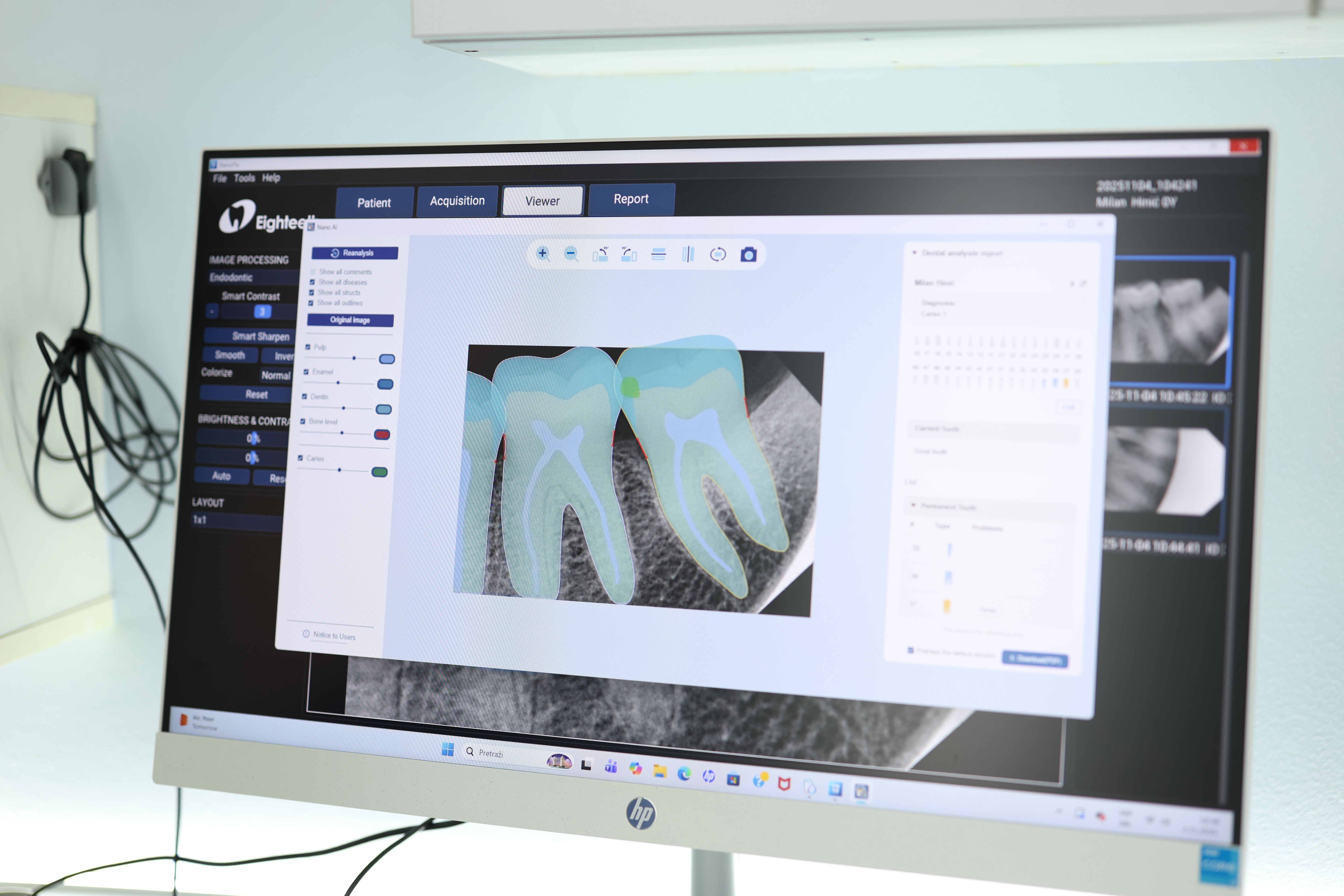Digitalni rendgen / Digital Radiography 3