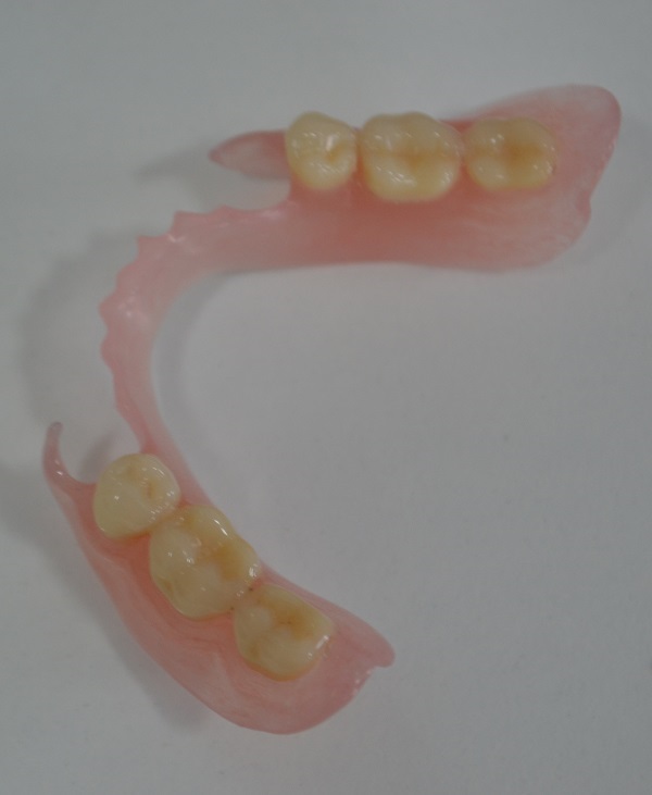 Termoplastične proteze